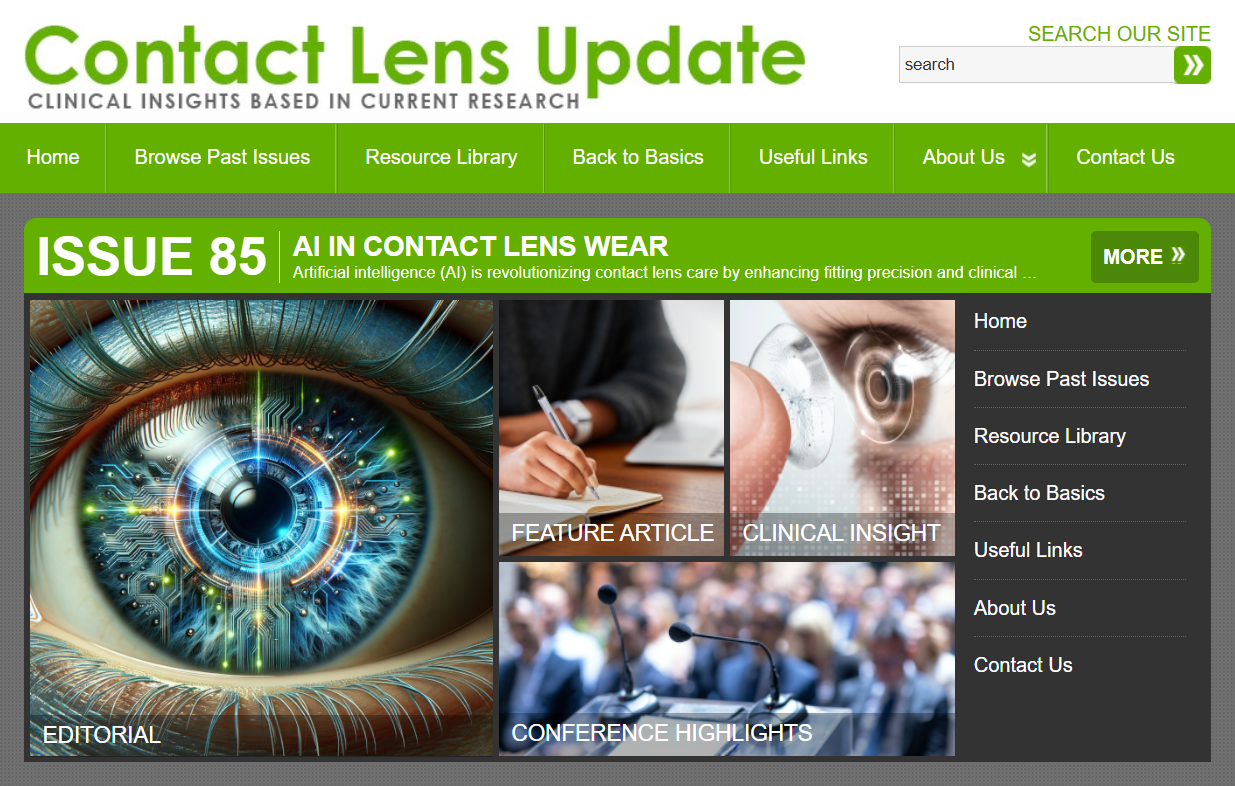 Capture d'écran du site web Contact Lens Update présentant le numéro 85 axé sur l'IA dans le port de lentilles de contact. La page présente un œil numérique futuriste avec des motifs de circuits et des éléments lumineux comme image principale, accompagné de sections pour l'Éditorial, l'Article de fond, l'Aperçu clinique et les Points saillants de conférence. L'en-tête du site affiche les options du menu de navigation et le slogan 'Aperçus cliniques basés sur la recherche actuelle.