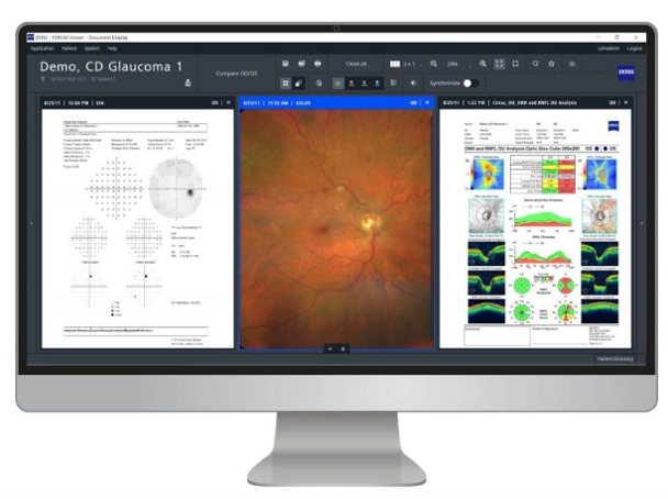 Le logiciel de gestion de données ZEISS FORUM affiché sur un moniteur de bureau, montrant les données diagnostiques d'un patient atteint de glaucome, notamment les résultats du champ visuel, une photographie du fond de l'œil et des graphiques d'analyse OCT dans une interface de revue clinique multi-panneaux.