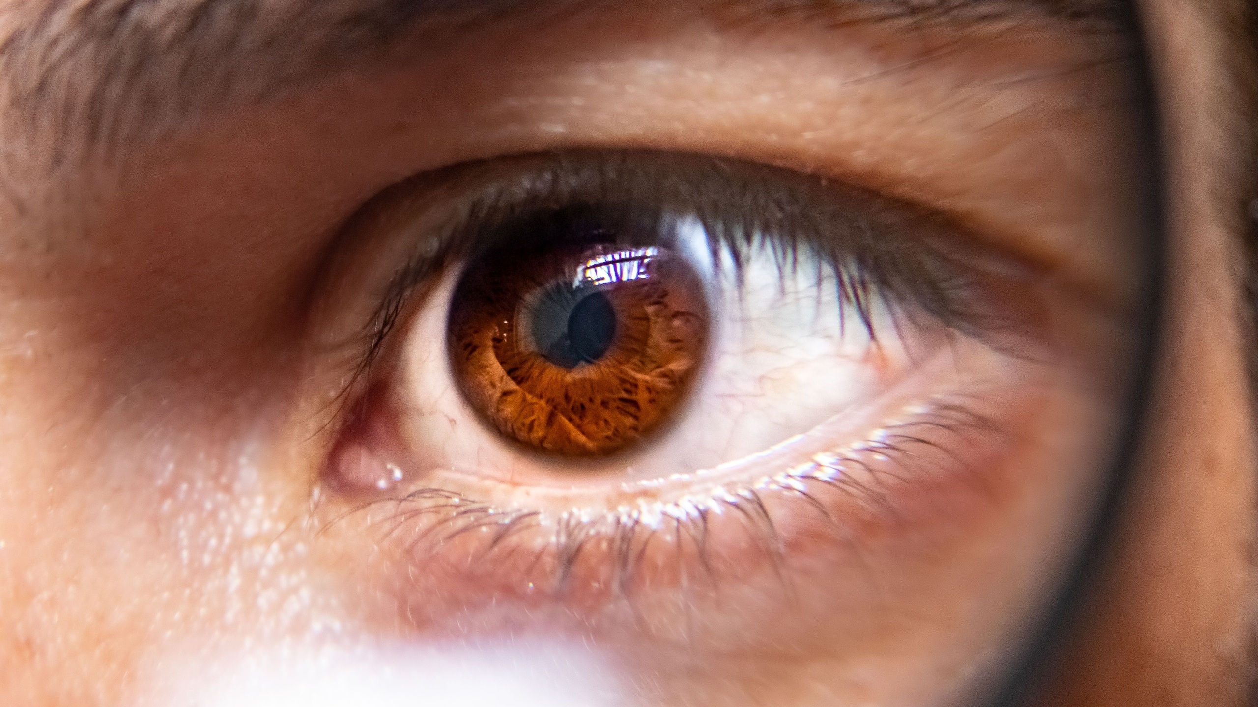 Gros plan d'un œil humain à l'iris brun vu à travers une loupe, présentant une légère rougeur au coin interne, illustrant les effets de l'œil sec.