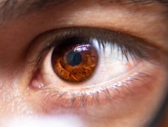 Close-up of a human eye with a brown iris viewed through a magnifying glass, showing slight redness along the inner corner, illustrating the effects of dry eye.